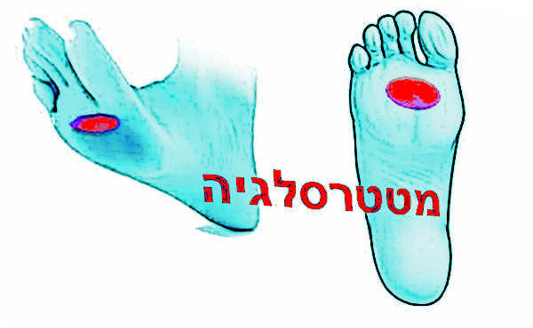 דורבן כף הרגל